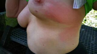 meine Brüste 200 Schläge auf den nackten Busen outdoor