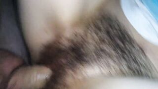 Constricted curly vagina.