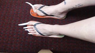 Very lengthy toenails in flipflops