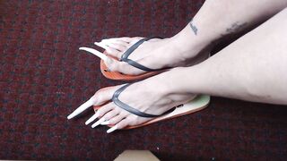 Very lengthy toenails in flipflops