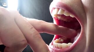 Hard Biting of Boy Fingers and Arm Film three Throat and Teeth Fetish!
