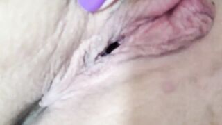 Vagina gaping after queef