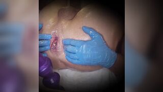 Milk anal enema, the 1st? anal fetish ?????