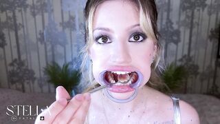 Teeth Fetish Extraordinary Close-up Dental Scrutiny