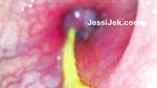 Plumber's Endoscope Stuk in My Booty Showed Hawt Anal Creampie From Inside