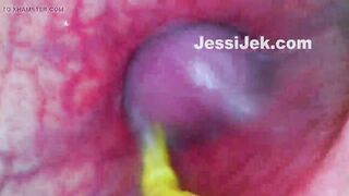Plumber's Endoscope Stuk in My Booty Showed Hawt Anal Creampie From Inside
