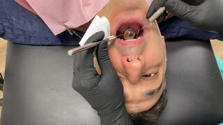 Nurse Bunny Checks Dr. Canada's Teeth Multi Angle
