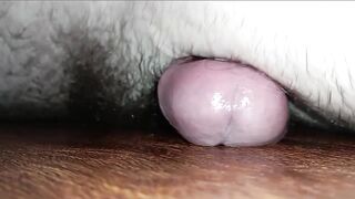 After Taking Viagra My Erection Lasted Longer Than 20 Four Hours
