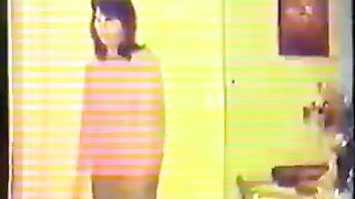 One Arm Amputee pretender Girls