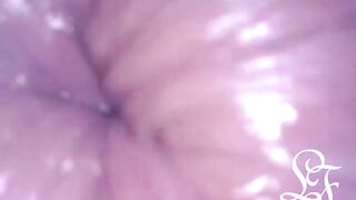 Exploring the Depths of my Butt with the Minicam!