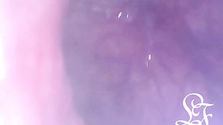 Exploring the Depths of my Butt with the Minicam!