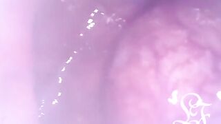 Exploring the Depths of my Butt with the Minicam!