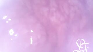 Exploring the Depths of my Butt with the Minicam!