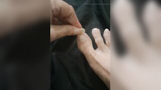 Lengthy Toenail Clipping