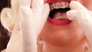 Snatch masturbation, braces fetish, medical gloves - mother I'd like to fuck Arya Grander solo masturbation