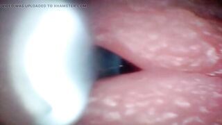 Endoscope Camera Captures Pont of time of Hunk Jizz flow 4K