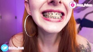 Braces Fetish Close-Up