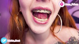 Braces Fetish Close-Up
