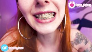 Braces Fetish Close-Up