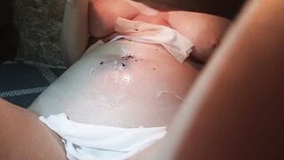 three months preggy abdomen punishment with wax