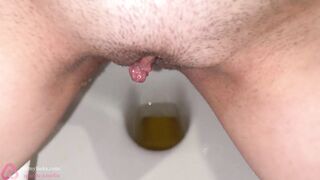 Morning collection of yellow pee! Check out my pads and pants!