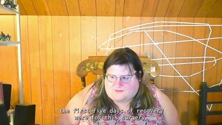 three Month Breast Augmentation Update