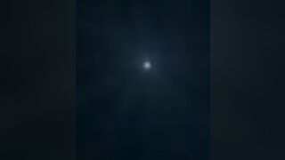 18 years girl gyno exam