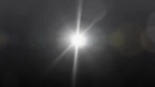 Nyxon Feet ticking therapy-Part 2