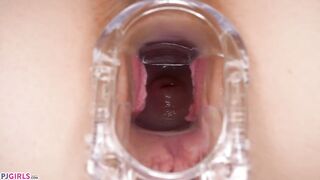 PJGIRLS - Gyno Comparison Exam - Teen Lesbians Play Gynecologist in Comparative Speculum Examination