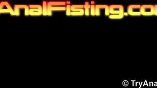 Lesbian Teen Anal Fisting (BIG ASS, Big Ass, Big Ass, Big Ass, Big Ass, Big ass, Big Ass)