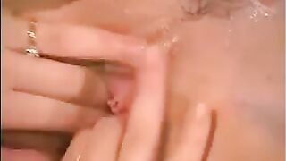 NML