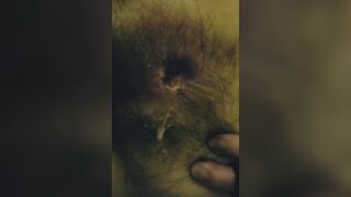 Tiny disabled whore takes anal pounding from nurse painful