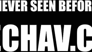 Mature Czech Woman Squirting With Estrogenolit