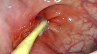 EXTREME ANAL POV. CAMERA INSIDE HER ASSHOLE AS I POUND HER WITH MY BIG COCK AND CUM DEEP INSIDE