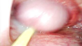 EXTREME ANAL POV. CAMERA INSIDE HER ASSHOLE AS I POUND HER WITH MY BIG COCK AND CUM DEEP INSIDE