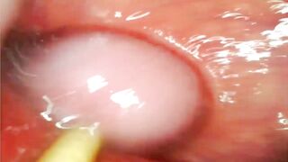 EXTREME ANAL POV. CAMERA INSIDE HER ASSHOLE AS I POUND HER WITH MY BIG COCK AND CUM DEEP INSIDE
