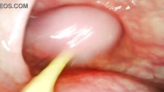 EXTREME ANAL POV. CAMERA INSIDE HER ASSHOLE AS I POUND HER WITH MY BIG COCK AND CUM DEEP INSIDE