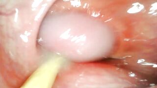 EXTREME ANAL POV. CAMERA INSIDE HER ASSHOLE AS I POUND HER WITH MY BIG COCK AND CUM DEEP INSIDE