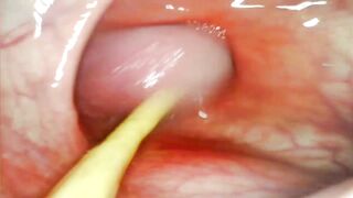 EXTREME ANAL POV. CAMERA INSIDE HER ASSHOLE AS I POUND HER WITH MY BIG COCK AND CUM DEEP INSIDE