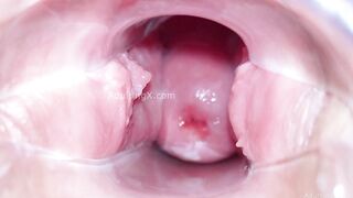 Cervix Display and Speculum Play