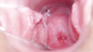 Cervix Display and Speculum Play