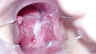 Cervix Display and Speculum Play