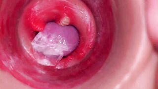 The camera inside the deep pussy records a huge ejaculation with a stuck condom