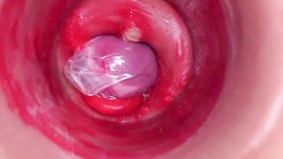 The camera inside the deep pussy records a huge ejaculation with a stuck condom