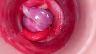 The camera inside the deep pussy records a huge ejaculation with a stuck condom