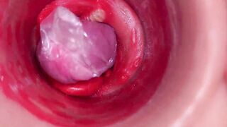 The camera inside the deep pussy records a huge ejaculation with a stuck condom