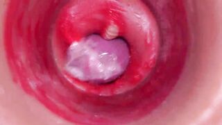 The camera inside the deep pussy records a huge ejaculation with a stuck condom