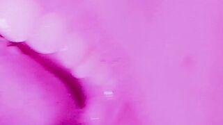 Willkommen in meinem Mund ????