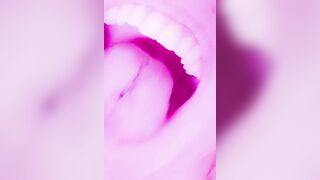 Willkommen in meinem Mund ????