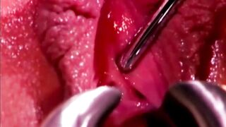 Lesbian's huge clit and thick labia toyed to squirt